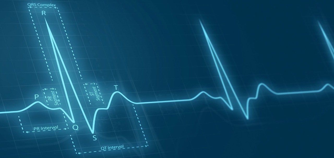 EKG readout on screen